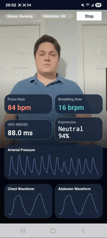 SmartSpectra Android quickstart demo